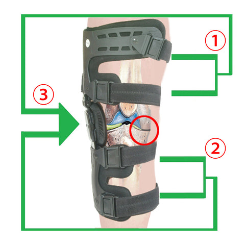 OA Lateral Unloader Knee Brace for Osteoarthritis, Arthritis Knee